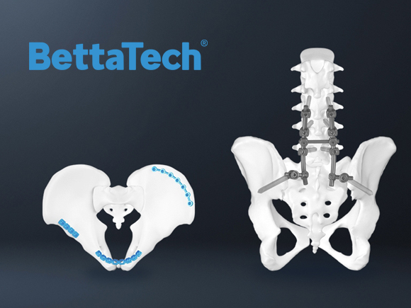 倍達(dá)醫(yī)療科技 Bettatec